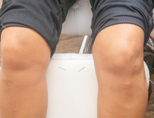 Acupuncture/Dry Needling for Knee Osteoarthritis