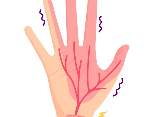 Carpal tunnel syndrome or referred neck pain/cervical nerve root compression?